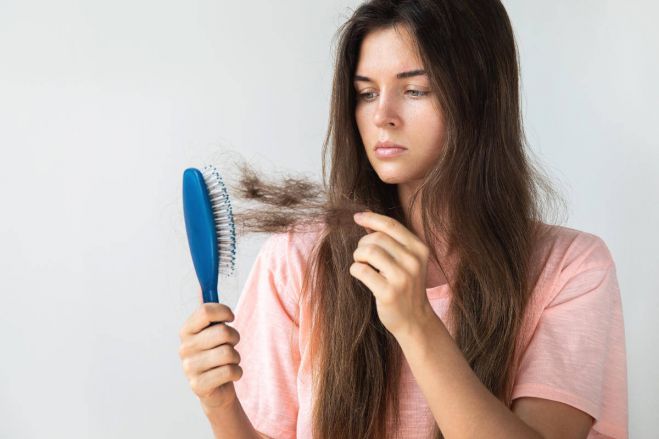 Perdita dei capelli: è allarme tra le ragazze soprattutto le giovanissime